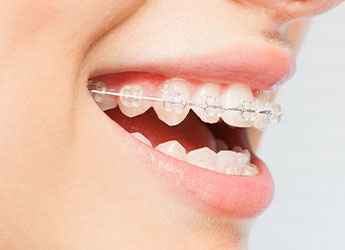 orthodontics03-01